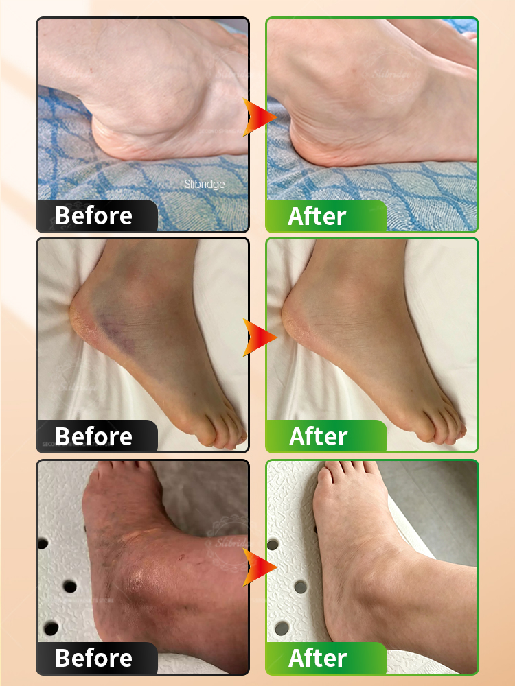 Tragbarer Beheizter Knöchelmas – Ankle Mobility Band Bewertung und Preis